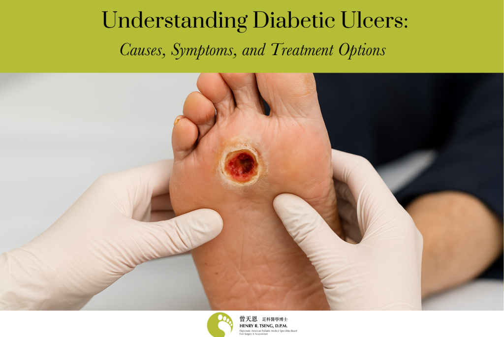 Diabetic Foot Ulcers Expert Treatment & Prevention Henry Tseng, DPM West Covina & Alhambra