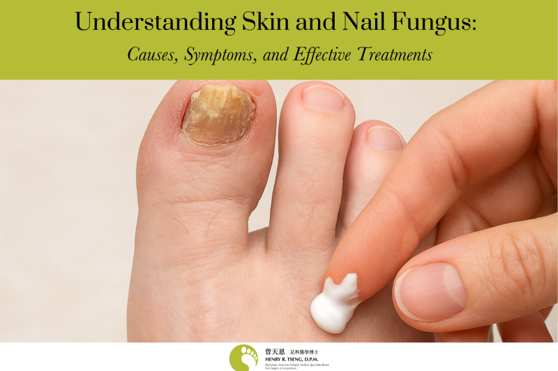 Understanding Skin and Nail Fungus Causes, Symptoms, and Effective Treatments